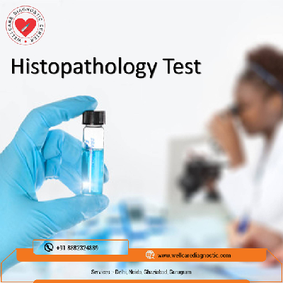 Histopathology Test