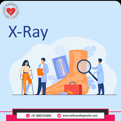 X-rays Center in Delhi