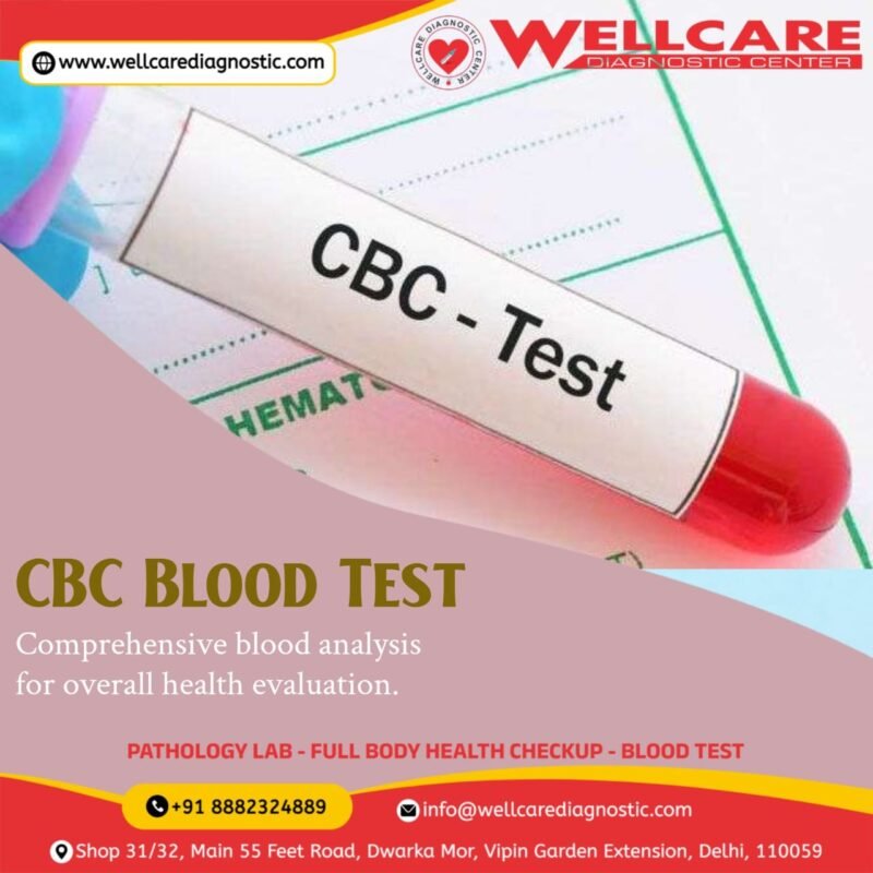 COMPLETE BLOOD COUNT (CBC) WITHP/S